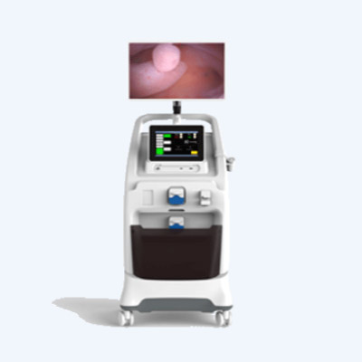 Histeroscopio electrónico desechable